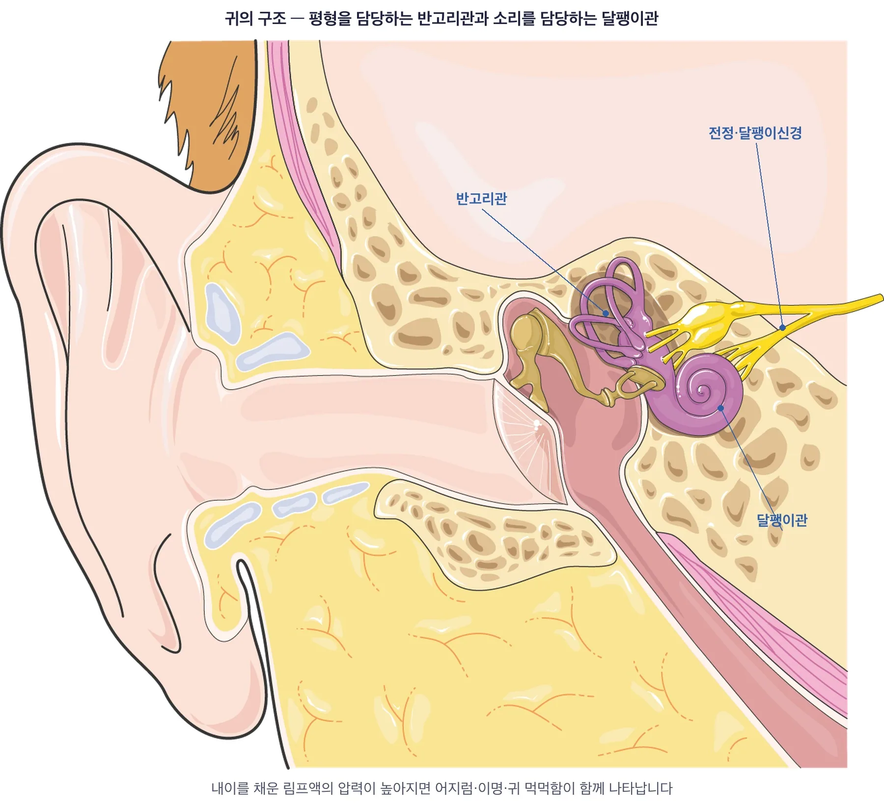 메니에르병, 어떻게 치료하나요? — 출처: 도해 Servier Medical Art (Smart-Servier) · CC BY-SA 3.0