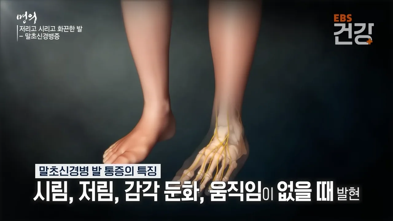 발 통증의 특징